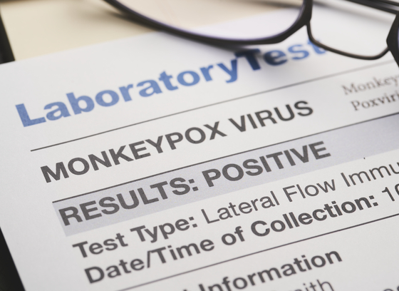 Monkeypox lab results